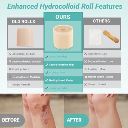 Upgraded 2in*16ft Hydrocolloid Roll for Wound Care, Hydrocolloid Patch Large Bandages with Self-Adhesive, Ultra Absorbent, Flexible, Waterproof, DIY Size, First Aid Kit Essential
