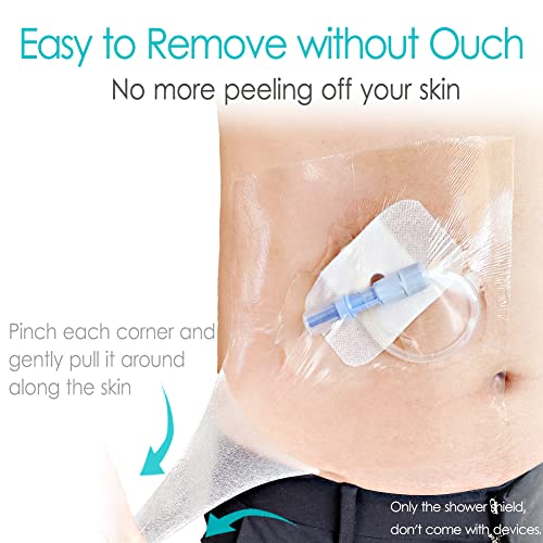 Waterproof Shower Protector Bandage 10x12 inch for Large Port Surgery Incisions Guard Tattoo Second Skin Healing Aftercare Cover Bath Patch Transparent Film Clear Adhesive Wounds Dressing (Pack of 25) - size: 10x12 Inch (Pack of 25)