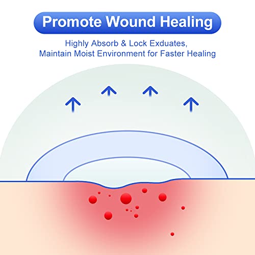 Niceful Hydrocolloid Bandages 2" x 4", 10 Count - size: 2" x 4" (10 Dressings)