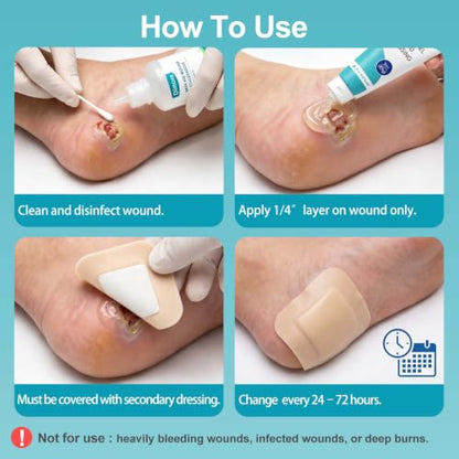 Dimora 2 Packs 6oz Hydrogel First Aid Ointment, Burn Injury Soothing Gel, Skin Repair Cream for Emergency Burn, Postoperative Incisions, Bruises, Debridement Wound Care - size: Hydrogel Gel 6 Ounce