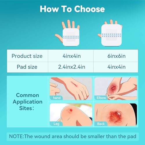 Dimora Hydrogel Burn Dressing with Border 4" x 4" (2.5" x 2.5" Pad) – Sterile, Waterproof Burn & Wound Dressing with Instant Cooling Relief for Minor Burns, Cuts & Abrasions (10 Count) - size: 4" x 4" (2.5" x 2.5" Pad)-10 Count