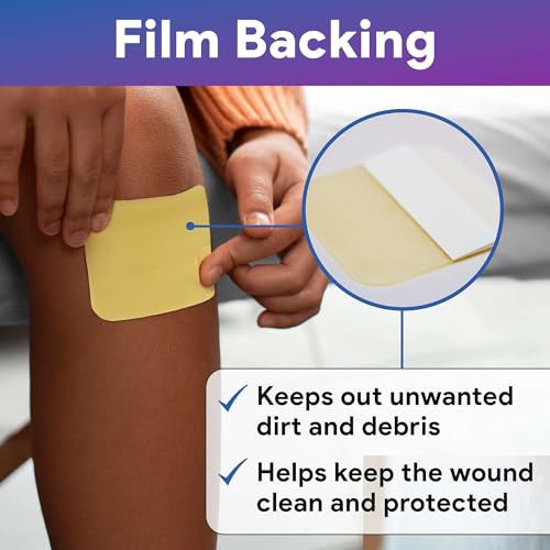 Honey Hydrogel Sheet Dressing 4.7"x3.4" - 10 Hydrogel Sheets with 30% Medical Grade Honey for Wounds - Good for Ulcers, Surgical Wounds, Donor Sites, Cuts, Abrasions, and More