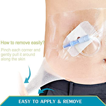 Tattoo Aftercare Bandage 6x6 inch Second Skin Healing Protective Clear Adhesive Film Dressing Supplies Cover for Large Port Surgery Incisions Guard Bath Wounds Patch (Pack of 50) - size: 6x6 Inch (Pack of 50)