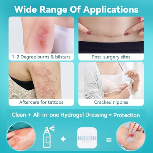 Dimora Hydrogel Burn Dressing with Border 4" x 4" (2.5" x 2.5" Pad) – Sterile, Waterproof Burn & Wound Dressing with Instant Cooling Relief for Minor Burns, Cuts & Abrasions (10 Count) - size: 4" x 4" (2.5" x 2.5" Pad)-10 Count