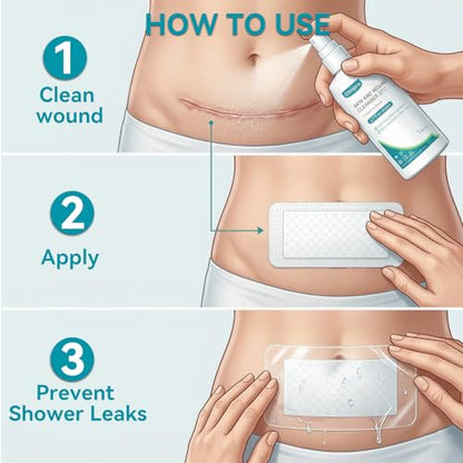 Dimora Silicone Foam Dressing Ag Silver Wound Care 4 x6 - size: 4"x6" Ag(10 PCS)