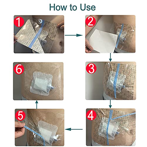 100Pcs Waterproof Shower Protector Bandage 4"x4.7" for Chest Chemo Port Dialysis Catheter Shower Cover Hemodialysis Surgery Incisions Guard Bath Patch Transparent Film Clear Adhesive Wounds Dressing - size: 4x4.7 Inch (Pack of 100)