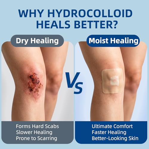 Niceful Large Hydrocolloid Bandages 4''x4'', 15 Count - size: 4" x 4" (15 Dressings)